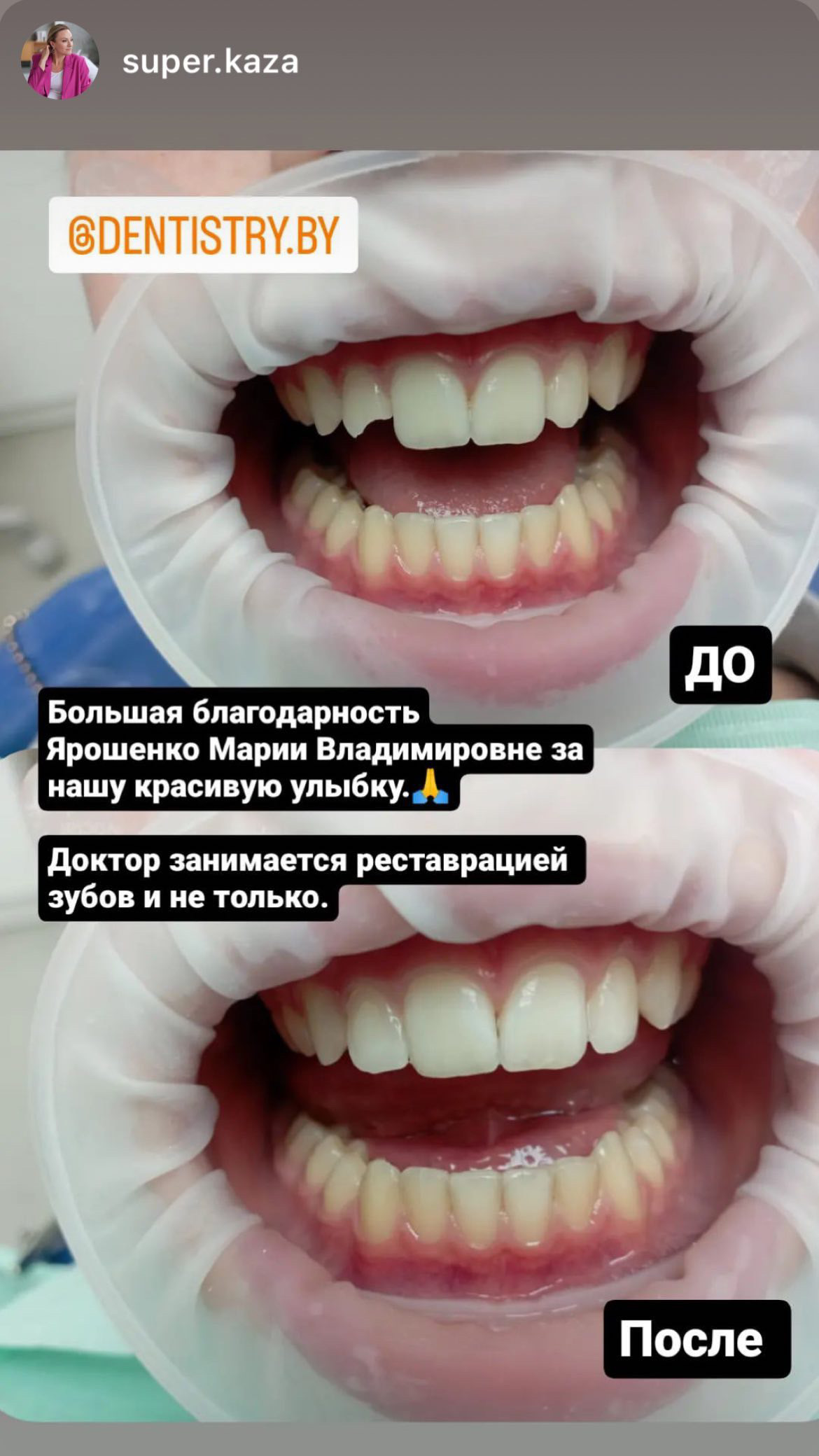 Отзывы пациентов стоматологии Dentistry