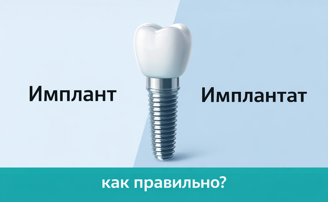 как правильно Имплант или имплантат