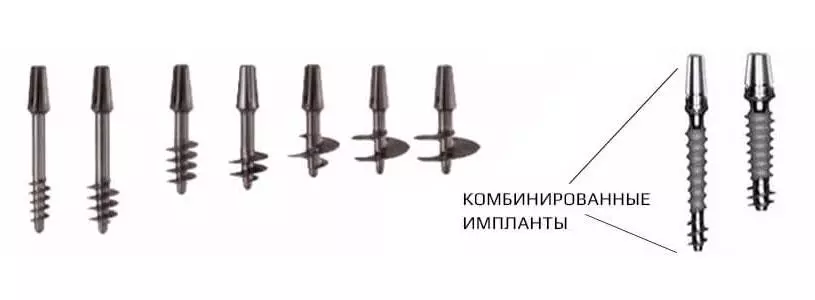 Классические, или современные базальные импланты