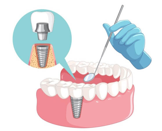 Реабилитационный период