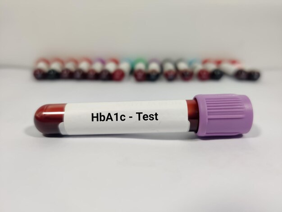 показатель&nbsp;HbA1c 