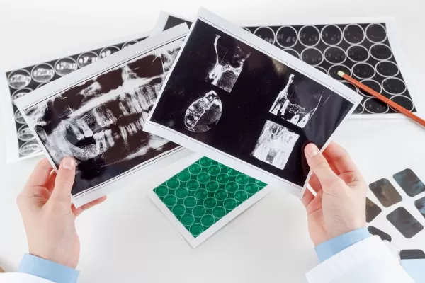 как происходит операция при имплантации зубов 