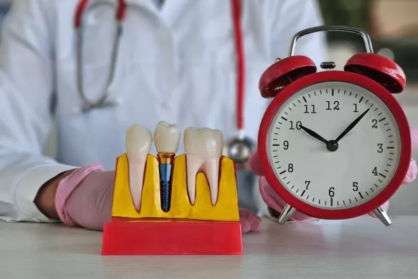 Срок службы имплантов зубов